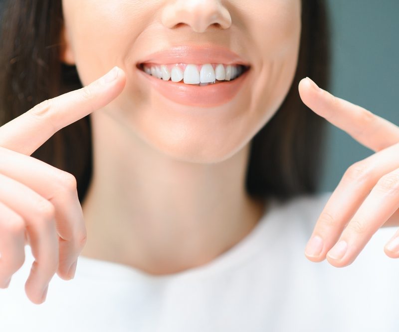 Close-up of a woman pointing at her teeth with a bright, even smile, showcasing natural-looking results from dental resin treatment - Dental Resin