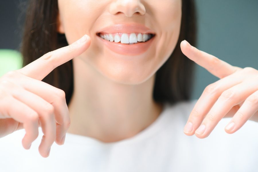 Close-up of a woman pointing at her teeth with a bright, even smile, showcasing natural-looking results from dental resin treatment - Dental Resin