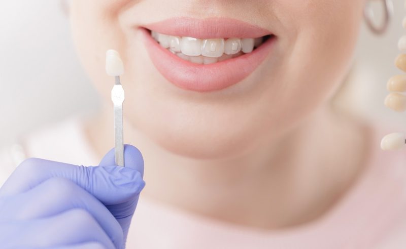 Female adult smiling while choosing dental veneer shade in dental clinic, stomatology concept.