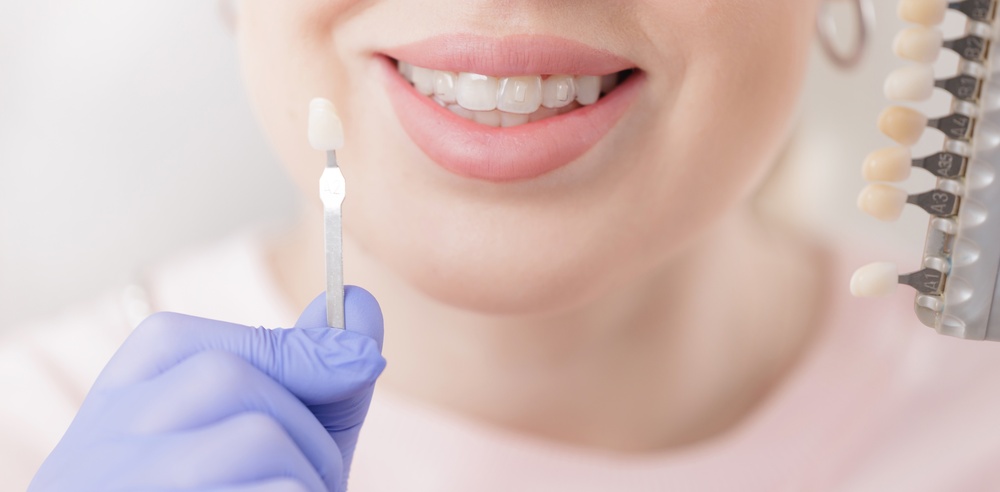 Female adult smiling while choosing dental veneer shade in dental clinic, stomatology concept.